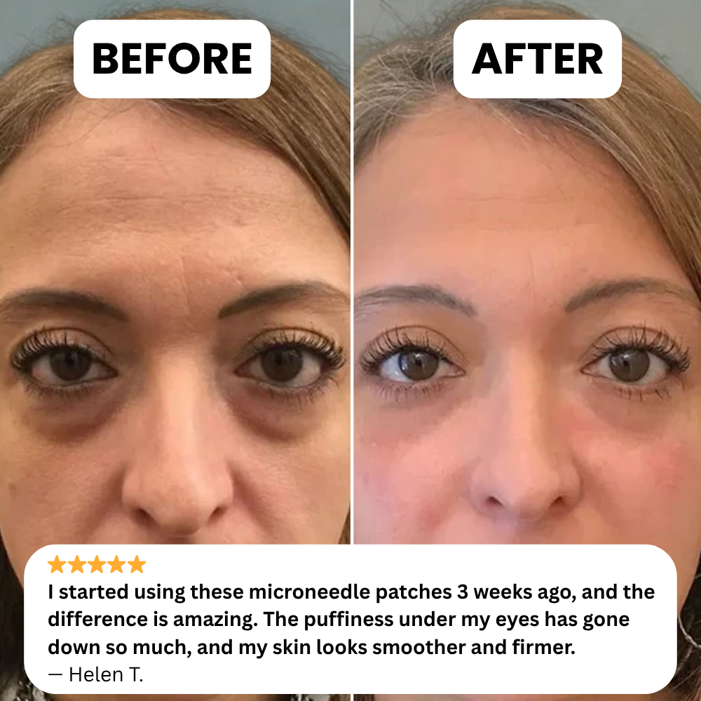 NOVELIA Microneedle Patches
