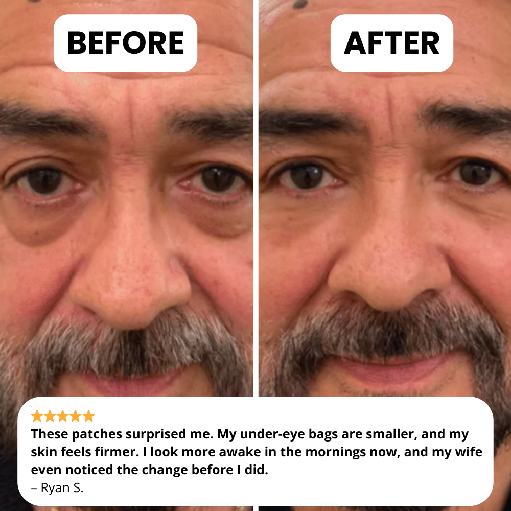 Novelia Microneedle Patches