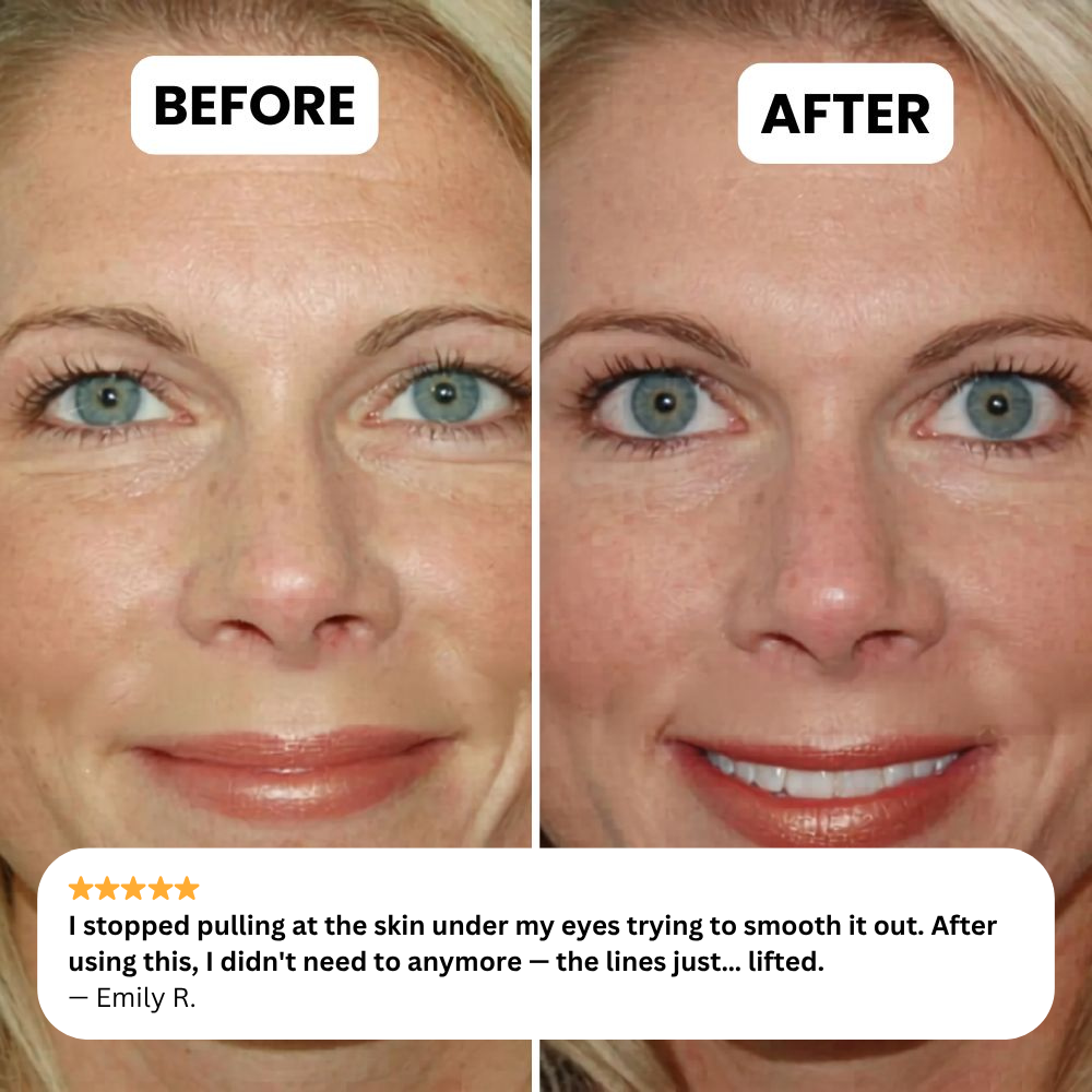 NOVELIA Microneedle Patches