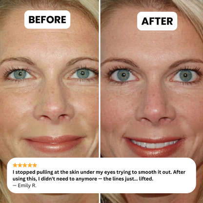 NOVELIA Microneedle Patches