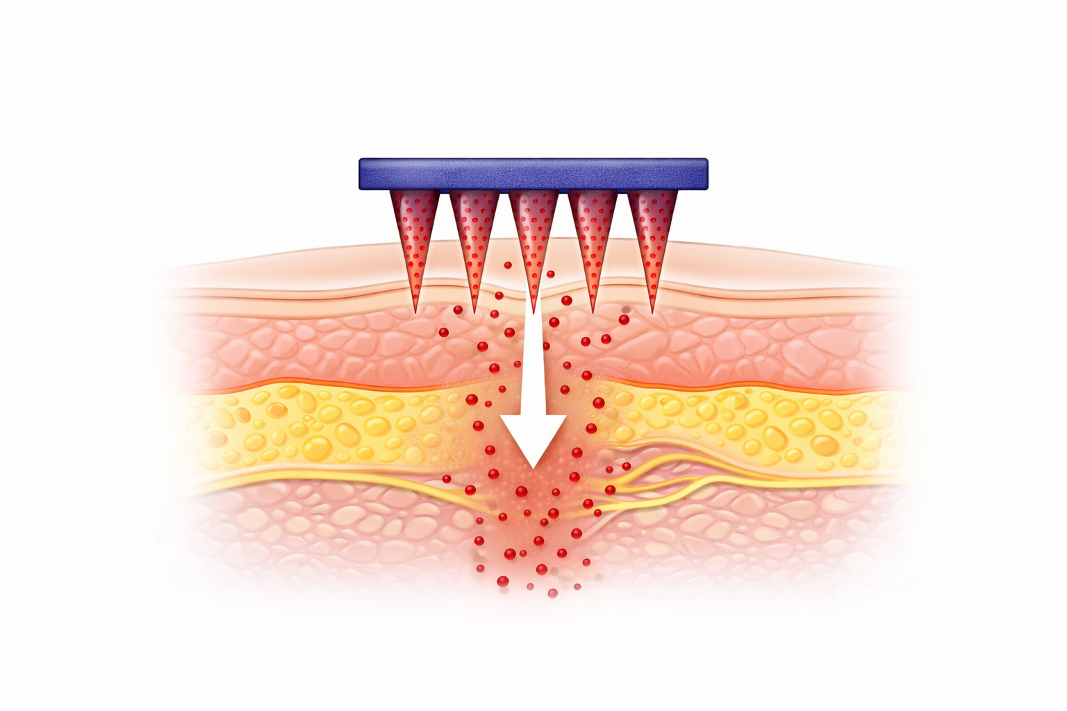 Hyaluronic acid and peptide Eye Patches with collagen-boosting ingredients