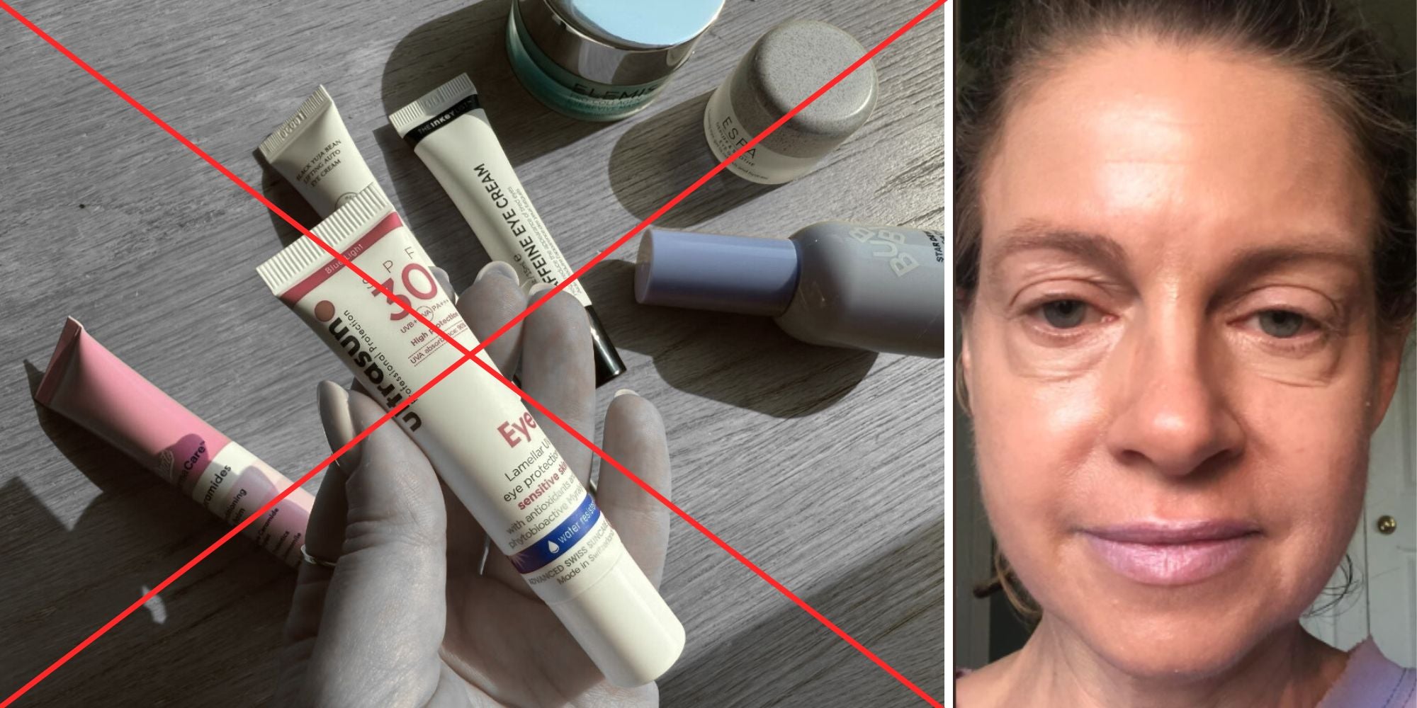 Before and after results using Eye Patches for dark circles and fine lines