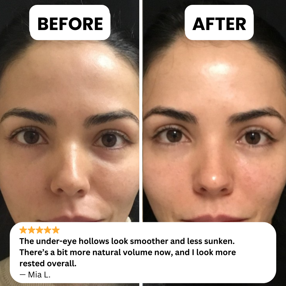 NOVELIA Microneedle Patches