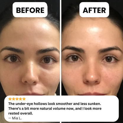 NOVELIA Microneedle Patches