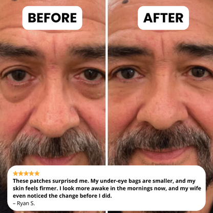 Novelia - Microneedle Patches