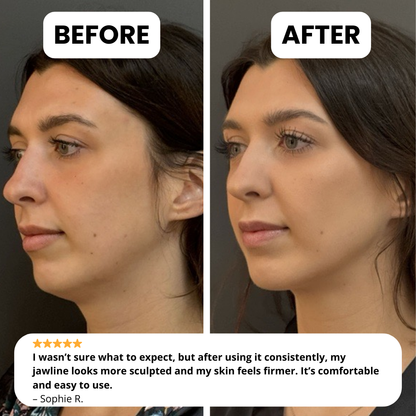 NOVELIA Jawline Sculpting Mask